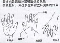 消化功能差该怎么调理,消化功能差的调理方法与生活改善策略”